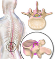 Dura mater (spinal section)